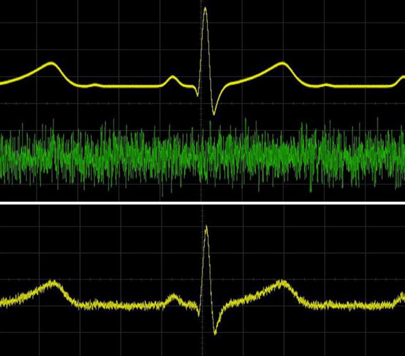 测试信号中添加受控噪声（上图）会产生嘈杂的 ECG 信号